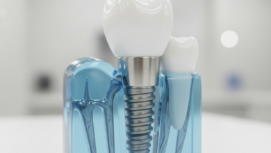 A photorealistic, ultra-detailed image displaying a complete dental implant system. A titanium screw-shaped implant post is firmly set into a translucent, stylized jawbone, indicating osseointegration. An abutment is attached to the implant, connecting it to a flawless, white ceramic crown that perfectly mimics a natural tooth. The background is softly blurred, depicting a clean and modern dental clinic setting, emphasizing the advanced technology and precision involved. No text is visible in the image.
