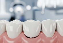 A photorealistic, ultra-detailed close-up of a natural-looking dental implant crown perfectly integrated into healthy, pink gum tissue. The background is a softly blurred, clean, and modern dental clinic setting, implying advanced and comfortable dental care.
