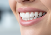 Close-up of a person's radiant, perfectly aligned, bright white smile, showcasing flawless teeth and healthy lips against a softly blurred, sophisticated background. The image emphasizes the beauty and confidence associated with cosmetic dentistry, suggesting celebrity-level dental perfection without showing any text or symbols.