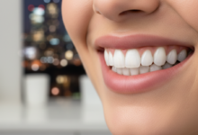Close-up of a person's mouth with a bright, perfectly aligned smile, set against a blurred background of a modern dental clinic and a very subtle hint of a UK city, representing cosmetic dental veneers and their cost in the UK.