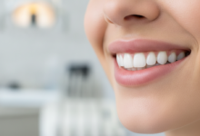 A close-up, photorealistic image of a person's radiant, healthy smile with perfectly aligned, bright white teeth. The background is a soft, blurred bokeh of a modern, clean dental clinic interior.