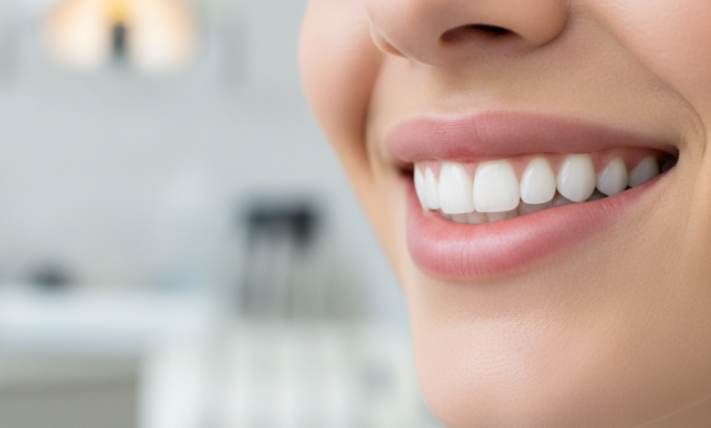 A close-up, photorealistic image of a person's radiant, healthy smile with perfectly aligned, bright white teeth. The background is a soft, blurred bokeh of a modern, clean dental clinic interior.