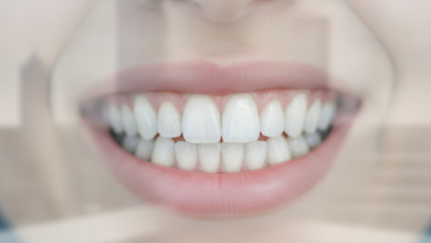 Close-up, soft-focus shot of a healthy, natural-looking smile with perfectly aligned, bright teeth, symbolizing successful cosmetic dental work. The background features a very blurred, abstract modern dental clinic setting, with faint, indistinct architectural elements suggestive of a UK city environment.