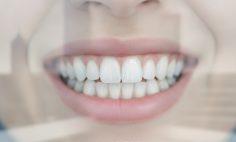 Close-up, soft-focus shot of a healthy, natural-looking smile with perfectly aligned, bright teeth, symbolizing successful cosmetic dental work. The background features a very blurred, abstract modern dental clinic setting, with faint, indistinct architectural elements suggestive of a UK city environment.