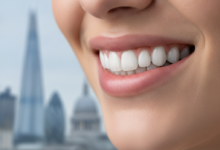 Close-up of a healthy, bright smile with perfectly aligned teeth, subtly hinting at advanced dental implant work. The background features a softly blurred London cityscape with recognizable landmarks, conveying high-quality dental care in a prominent urban setting.
