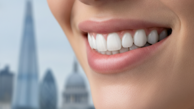 Close-up of a healthy, bright smile with perfectly aligned teeth, subtly hinting at advanced dental implant work. The background features a softly blurred London cityscape with recognizable landmarks, conveying high-quality dental care in a prominent urban setting.
