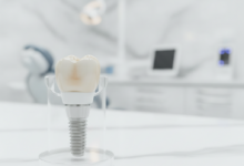 Close-up photorealistic image of a sophisticated 3D dental implant model, consisting of the titanium post, abutment, and crown. It's positioned in a modern, blurred dental clinic setting in the UK, with cinematic lighting and a shallow depth of field. The image emphasizes precision, advanced technology, and professional dental care.