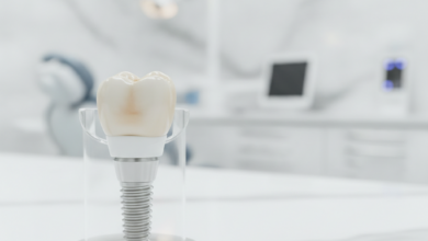 Close-up photorealistic image of a sophisticated 3D dental implant model, consisting of the titanium post, abutment, and crown. It's positioned in a modern, blurred dental clinic setting in the UK, with cinematic lighting and a shallow depth of field. The image emphasizes precision, advanced technology, and professional dental care.