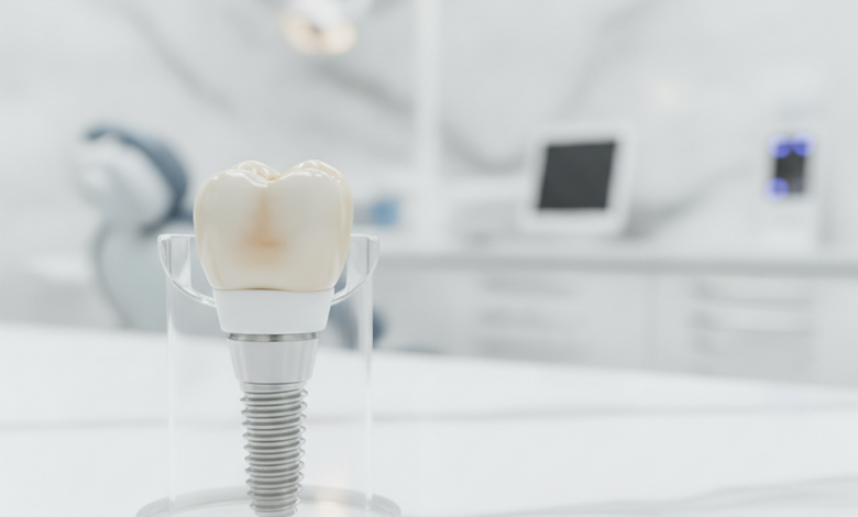 Close-up photorealistic image of a sophisticated 3D dental implant model, consisting of the titanium post, abutment, and crown. It's positioned in a modern, blurred dental clinic setting in the UK, with cinematic lighting and a shallow depth of field. The image emphasizes precision, advanced technology, and professional dental care.